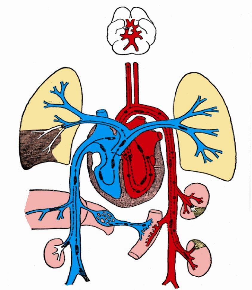 Common locations in which venous and arterial emboli cause infarction