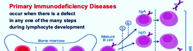 Immune Cell Development & PIDs: Occurs in Any Defective Step 1 Severe combined