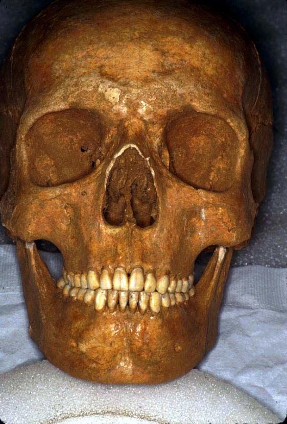 D19 Prehistoric skull has good facial form, beautiful dental occlusion and