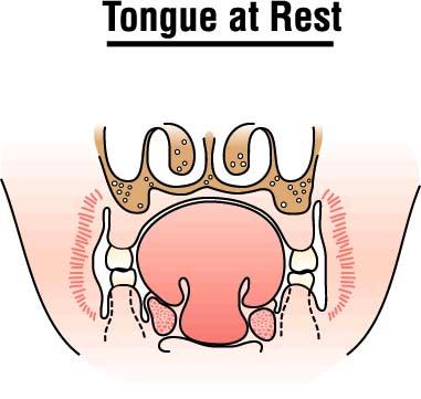 While at rest, the tongue does not exert abnormal forces on any of the structures within the oral cavity.