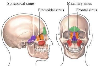 The Paranasal Sinuses These are air-filled spaces within the skull bones Serve to reduce weight of the skull