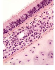Mucosa Pseudostratified ciliated columnar epithelium Lamina
