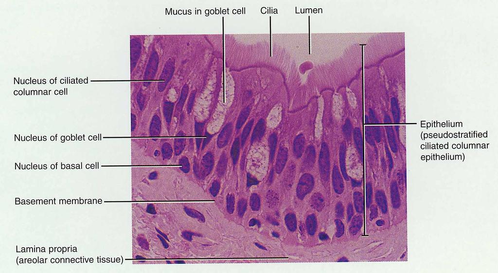 Airway Epithelium o Ciliated pseudostratified columnar epithelium with goblet cells