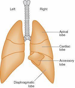 Hyaline Membrane Disease: Congenital Lung