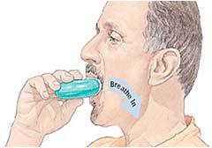 Decrease death Must take daily Side effects - Oral thrush yeast infection on tongue Side effects can be reduced by mouth-rinsing with warm water after