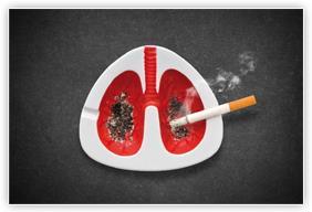 What to avoid Smoking: Smoking and exposure to smoke (passive smoking) can damage your lungs, and stop them from working properly 1) Increases mucus - more mucus-producing cells and glands grow in