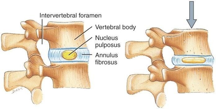 Vertebral Column 1) Functions protects