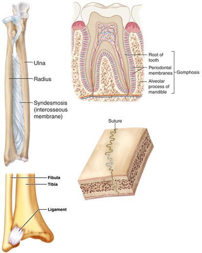 1) Sutures Short CT fibers Synarthrosis or amphiarthrosis 2) Syndesmoses longer CT fibers Diarthrosis