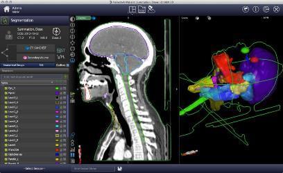 ADVANCED DATA ANALYTICS: Velocity TM Creates the cancer story from imaging Imaging