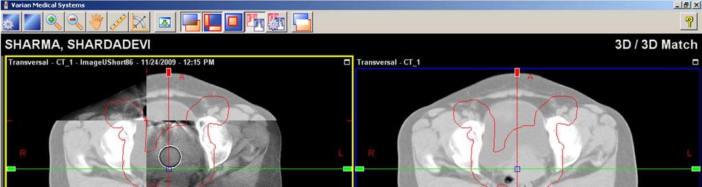 CBCT on Newer