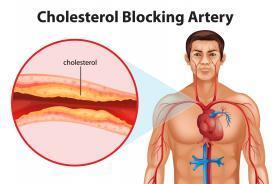 CHOLESTEROL NOT THE SAME AS FAT USED FOR
