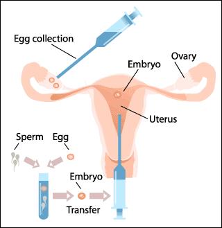 IVF More hormonal treatment (progesterone) Scan to check thickness of endometrium 2 or 3 embryos