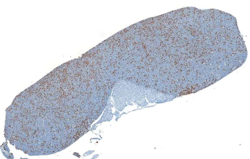 Pituitary LH IHC in