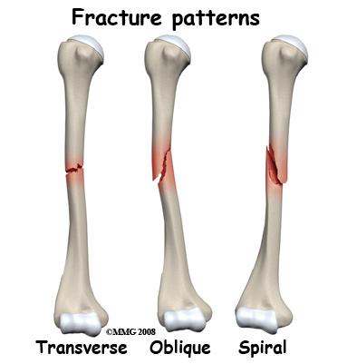 Anatomy A Patient's Guide to Adult Humerus Shaft Fractures Adult Humerus Shaft Fractures The humerus is the long, tubular bone that makes up the upper arm.
