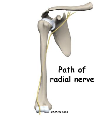 One of the nerves that travels from the neck to the hand, the radial nerve, spirals around the humeral shaft lying very close to the bone about two thirds of the way to the elbow.