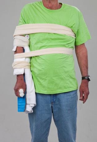 Elbow Injuries continued If elbow straight, apply rigid splint from upper arm to hand.