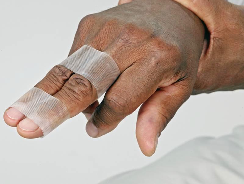 Finger Injuries Fractures and dislocations Often splint not required Use rigid splint