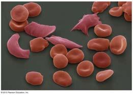 9.3 A single gene may affect many phenotypic characters Pleiotropy occurs when one gene influences many characteristics. Sickle-cell disease is a human example of pleiotropy.