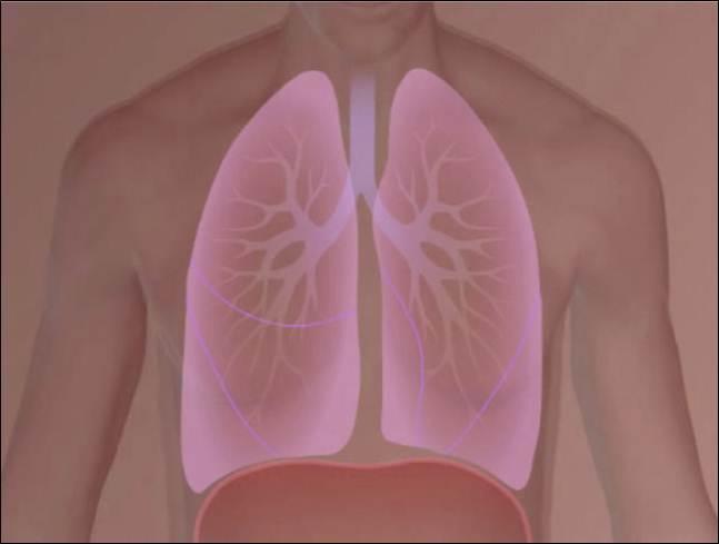 COPD Video Click the screenshot to view a