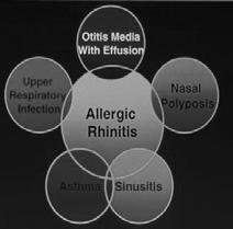 Airway, One Disease Allergic rhinitis affects : 25% of the general
