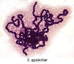 Streptococcus pyogenes Gram