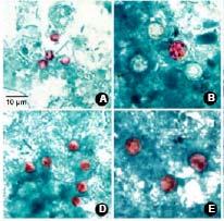 Comparison of Cyclospora cayetanensis and Cryptosporidium parvum Oocysts in stool smears stained with modified