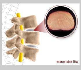 Fibrous Tissue Intervertebral Disc The intervertebral disc sits between the weight bearing vertebral bodies, servicing the spine as shock absorbers.