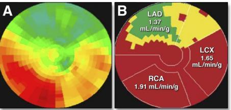 Polar Map of Myocardial Tracer Uptake During Adenosine