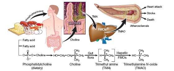 Phosphatidylcholine - Atherosclerosis Pro-inflammatory diet Phosphatidylcholine (enriched in