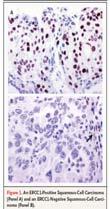N Engl J Med 2005;352:2589-2597 Tumor Biology Morphology Small cell Squamous Non-small cell Adeno (BAC, Invasive) Large cell