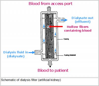 dialysis filter. If an adequate flow rate cannot be achieved by removing blood from the access side of a catheter, the catheter limbs can be reversed.