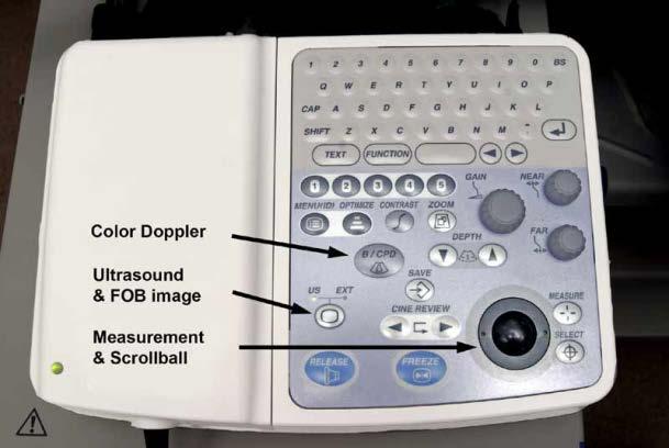 ultrasound image and plain-view endoscopic image are displayed on the same