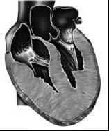 Sudden Cardiac Death (SCD) <35 years old Hypertrophic cardiomyopathy (HOCM) Congenital anomalies of coronary arteries Marfan s syndrome Myocarditis Valvular heart disease Coronary artery