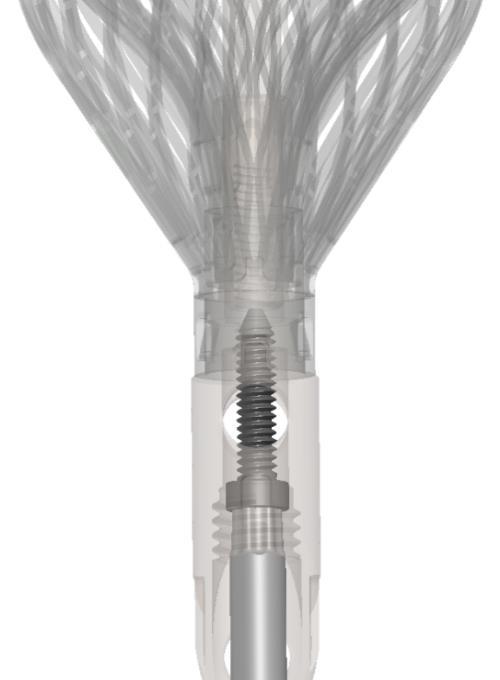 Step 4 Conventus CAGE TM PH Implant Delivery, Rotation and Locking Delivery Handle with preloaded Cage Delivery Tube Implant Rotation Instrument H10 Long Driver Advance Delivery Device up to target