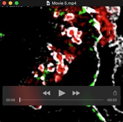 Movie 5. Actin polymerization promotes macrophage plasma membrane contact with agldl and sequestration of portions of the aggregate.