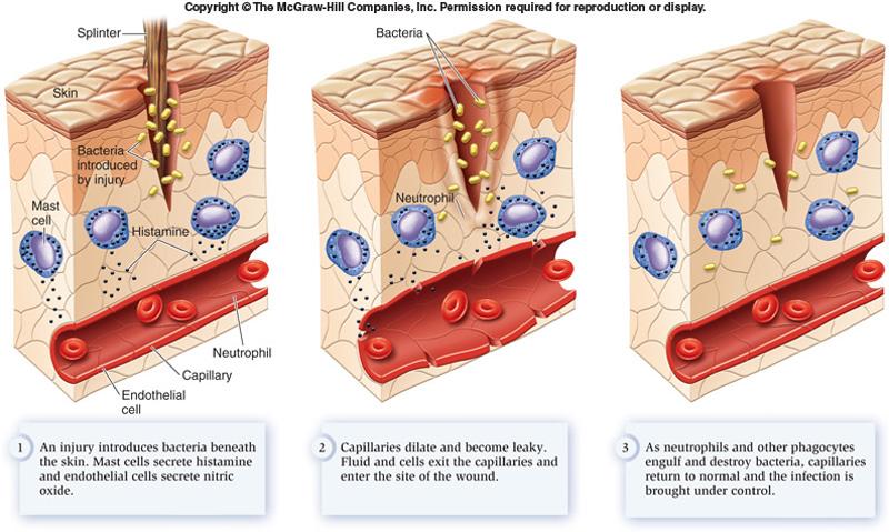 Innate Immune System Inflammation Injury introduce bacteria Mast cells secrete Histamine and endothilial cells secrete nitric oxide => Dilation of vessel neutrophil