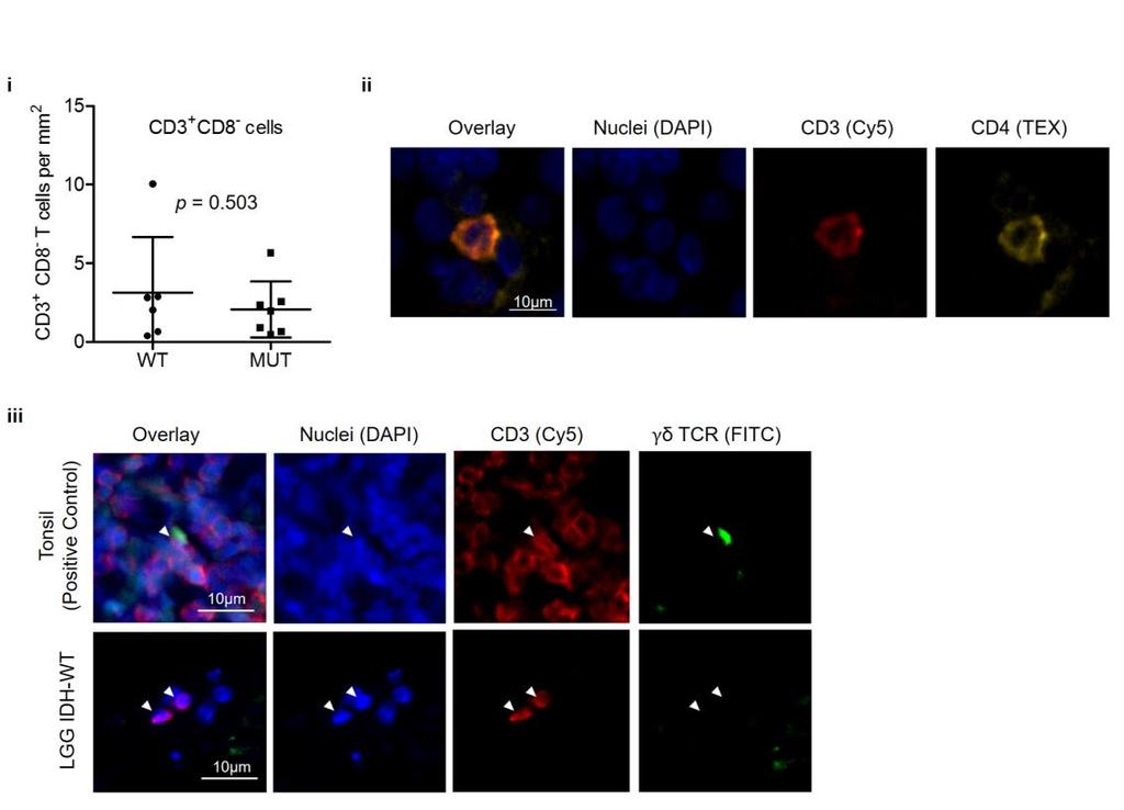 Supplementary Figure 3. CD3 + CD8 - cells/mm 2 in WHO grade III gliomas.