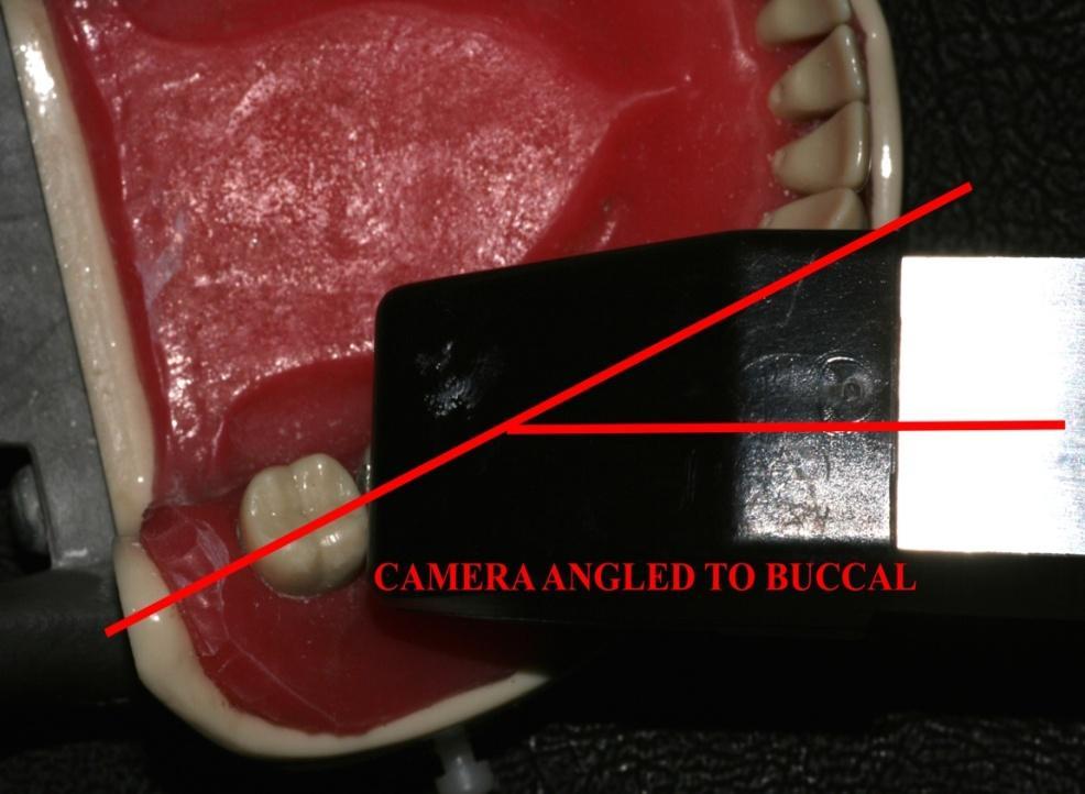 Training (learning curve) and Continued Education Types of Intraoral Cameras 1) Static Camera Systems -have a steeper