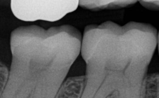Maximized Adhesive Dentistry