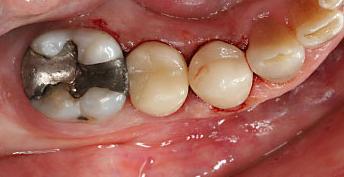 Maximized Adhesive Dentistry