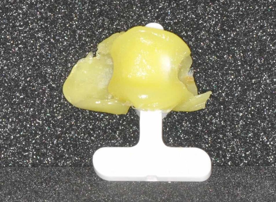 Material adapted to adjacent teeth.