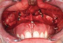 profile showing prognathism. 2 Clinical picture showing the class III malocclusion.