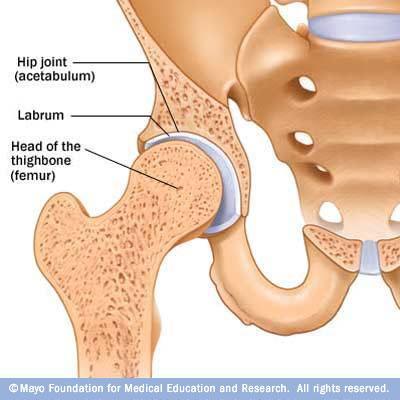 Causes of Hip