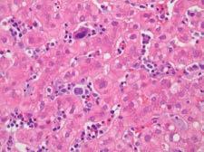 Hepatopancreaticobiliary Pathology The Hepatopancreaticobiliary Pathology service provides diagnostic interpretations and consultations for biopsy and resection specimens from the liver, biliary