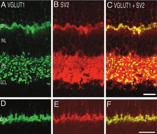 VGLUT1 expression is confined to the outer and inner plexiform layers where vesicular glutamate transmission occurs. In the OPL, there is intense VGLUT1 immunolabeling.