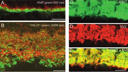 520 J. Neurosci., January 15, 2003 23(2):518 529 Johnson et al. Vesicular GABA and Glycine Precede Glutamate in Retina Figure 4. VGLUT1 is not expressed in GABAergic neurons.