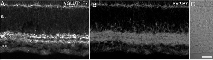 Johnson et al. Vesicular GABA and Glycine Precede Glutamate in Retina J. Neurosci., January 15, 2003 23(2):518 529 523 which was double-labeled with an antibody to LacZ (Fig. 3E).
