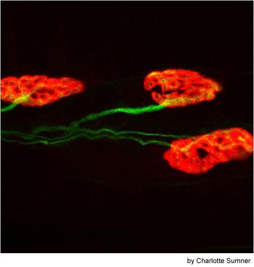 After a motor neuron axon makes contact with the muscle fiber, receptors become concentrated at the point of contact (i.