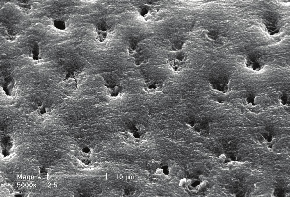 surface relief (SEM - 2,000x).