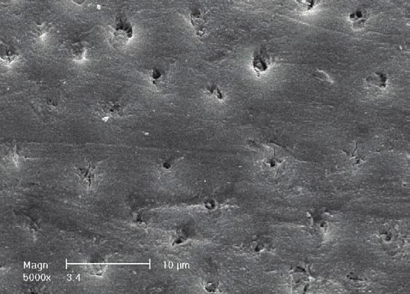 Deposition of obliterating material within the tubules was visible on SEM analysis (Figures 5, 6, and 7).